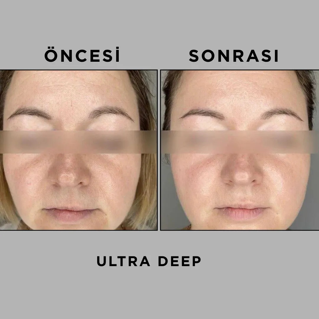 ULTRA DEEP – 50 ML