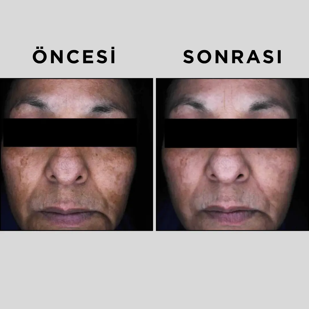 ALPHA BRIGHT SERUM 30 ml