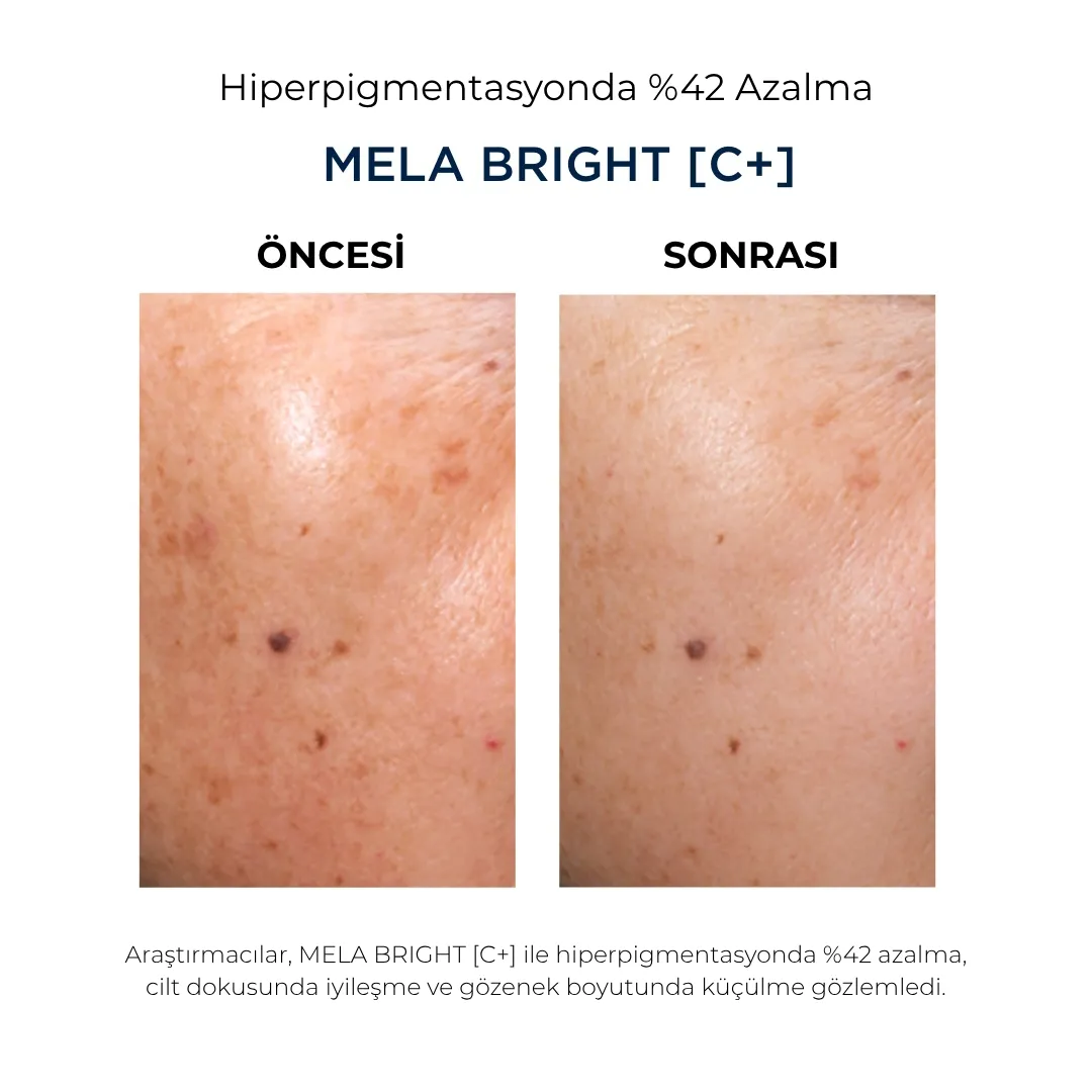 MELA BRIGHT (C+) SERUM 30 ml