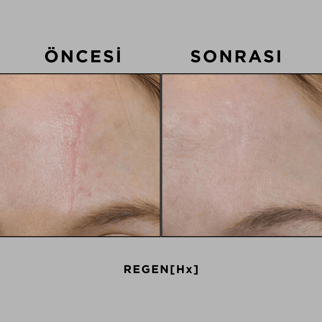 REGEN [Hx] 30 ml