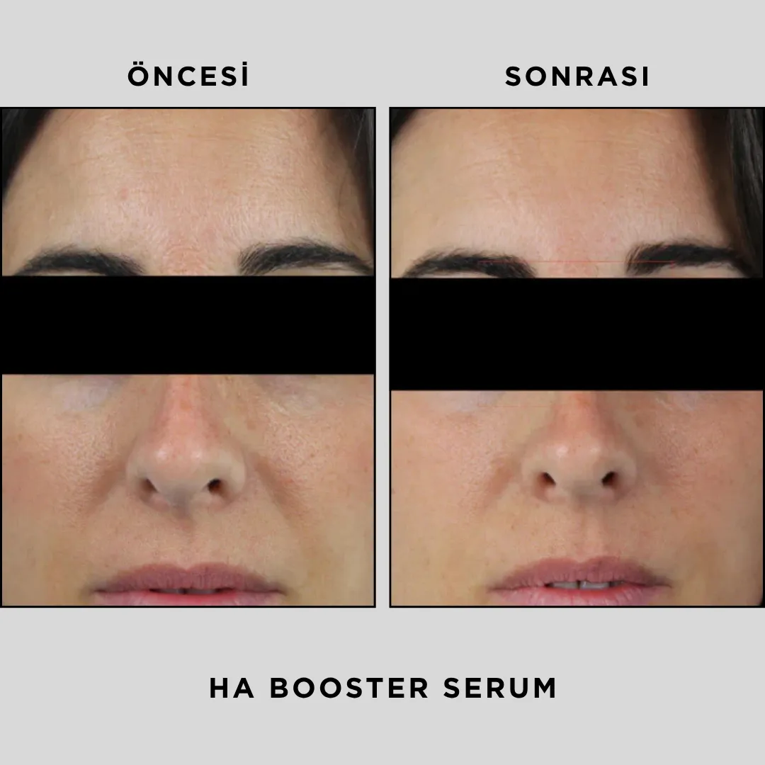HA BOOSTER SERUM 30 ml