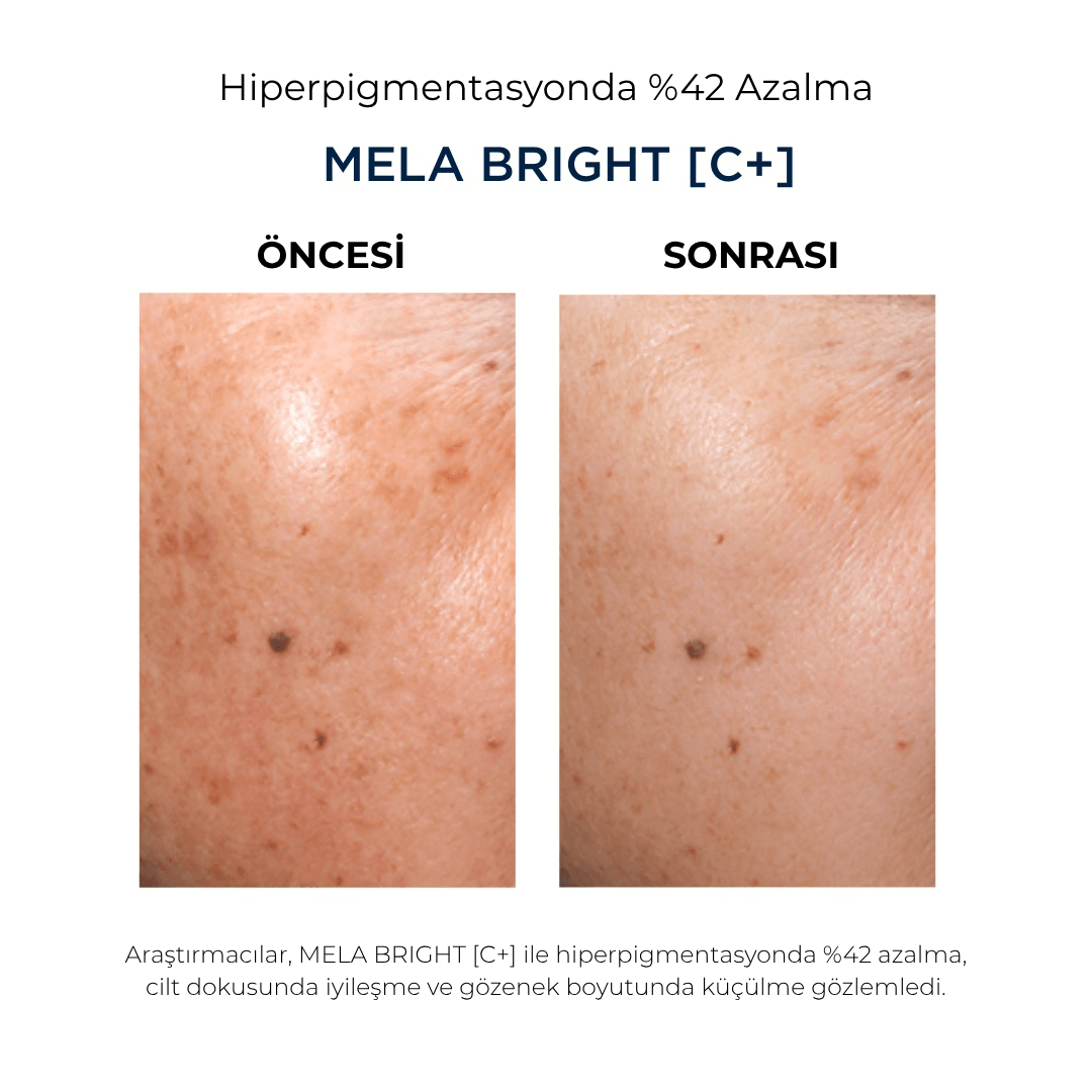 MELA BRIGHT (C+) SERUM 30 ml