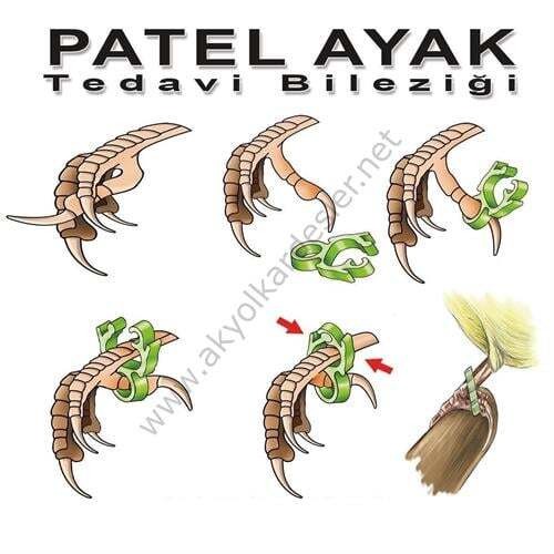 White Road Patel Ayak Tedavi Bileziği Seti 8 Adet