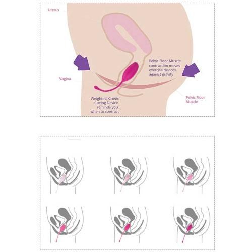 ROSE KEGEL EGZERSİZ TOP SETİ