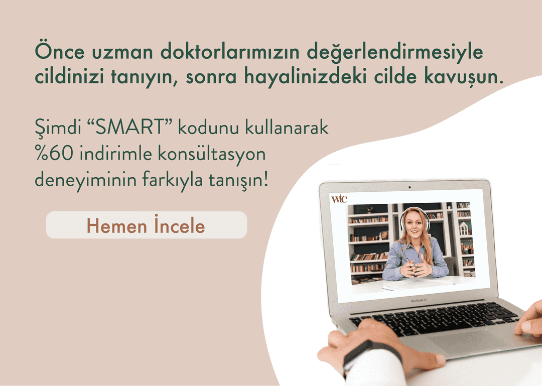 SMART Kodu ile İndirim