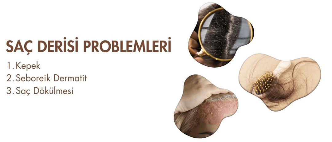 Saç Derisi Problemleri