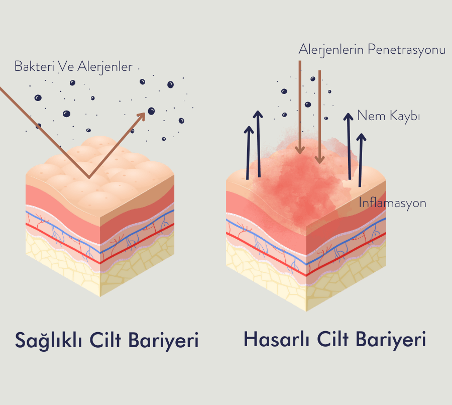 Sağlıklı vs. Hasarlı Cilt Bariyeri
