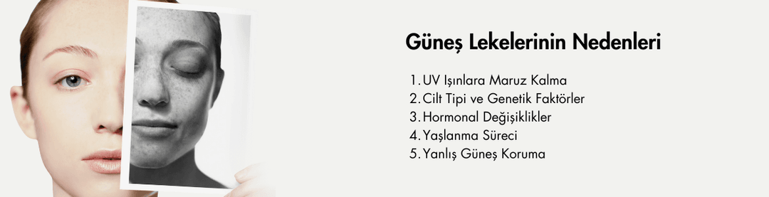 Güneş Lekelerinin Nedenleri