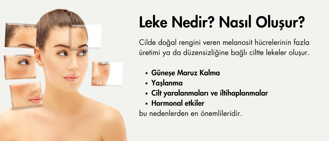 Leke Nedir? Nasıl Oluşur?
