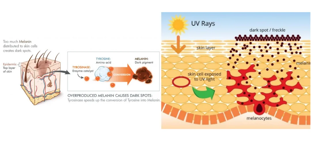 Melanin Üreten Hücrelerin Faktörlere Bağlı Olarak Değişimi