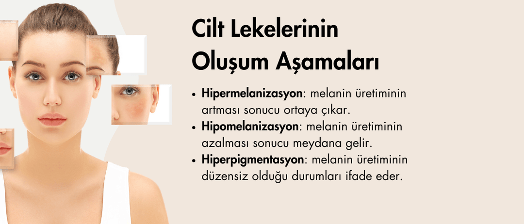 Cilt Lekelerinin Oluşum Aşamaları
