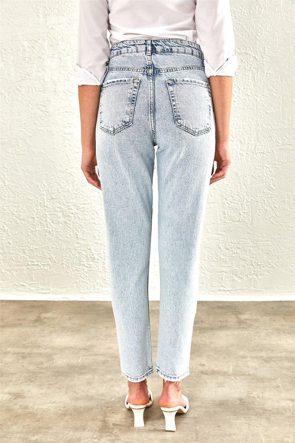 Kadın Dizleri Lazerli High Waist MOM Jeans