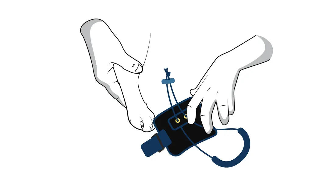 Positioning the knuckling brace over the ankle joint