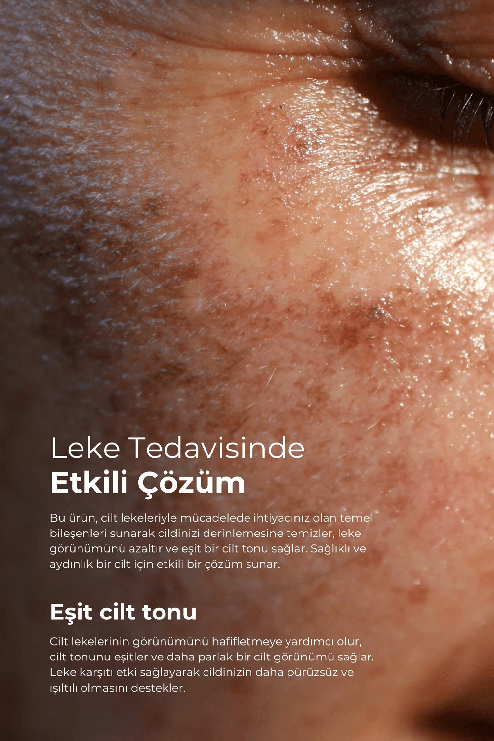 TTO Clinic Leke Serumu 50 ml