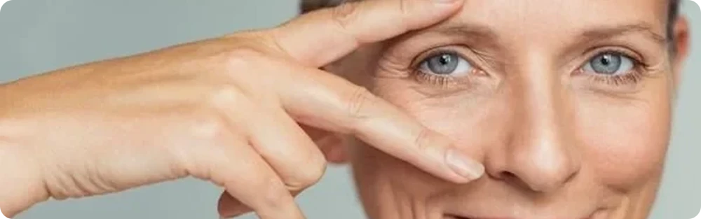 Göz Altı Torbaları ve Morlukları İçin En Etkili Çözümleri