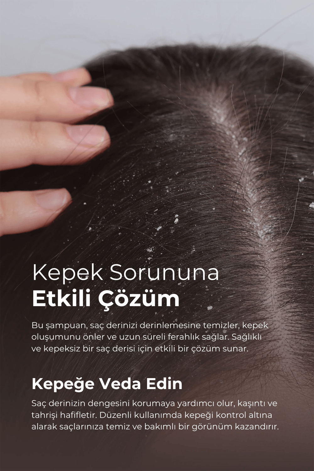 TTO Clinic Kepek ve Dökülme Karşıtı Şampuan 400 ml