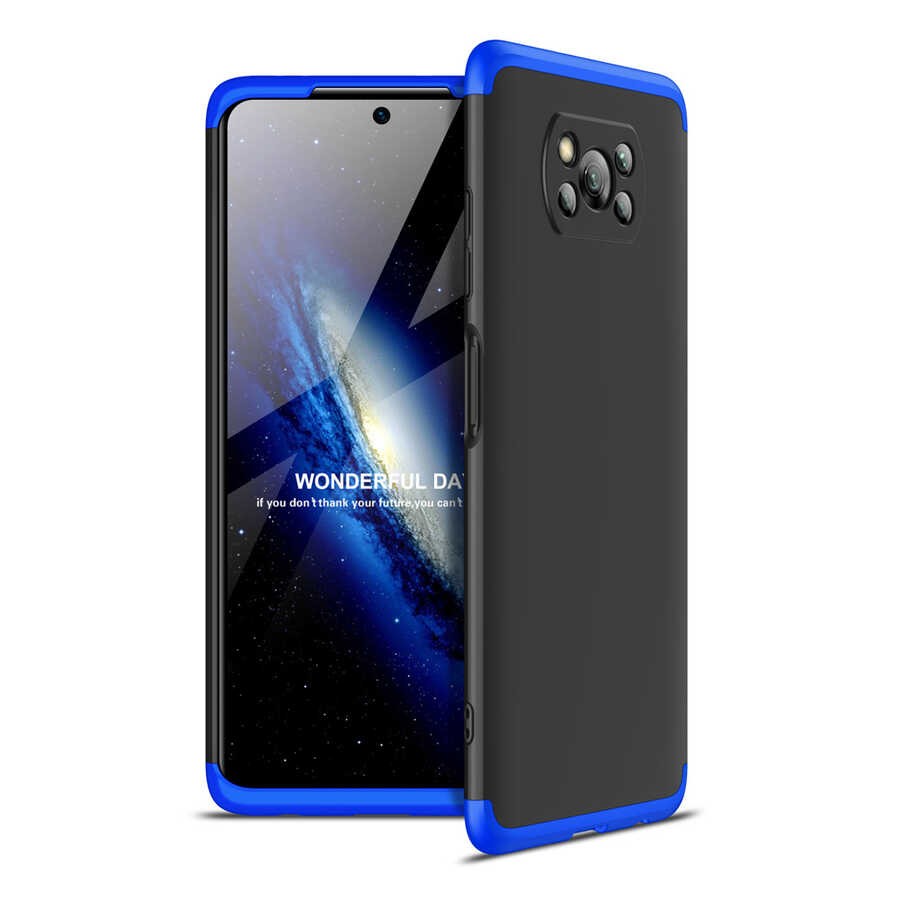 Xiaomi Poco X3 Kılıf Zore Ays Kılıf