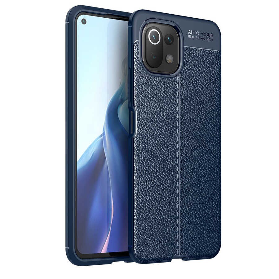 Xiaomi Mi 11 Lite Kılıf Zore Niss Silikon Kılıf