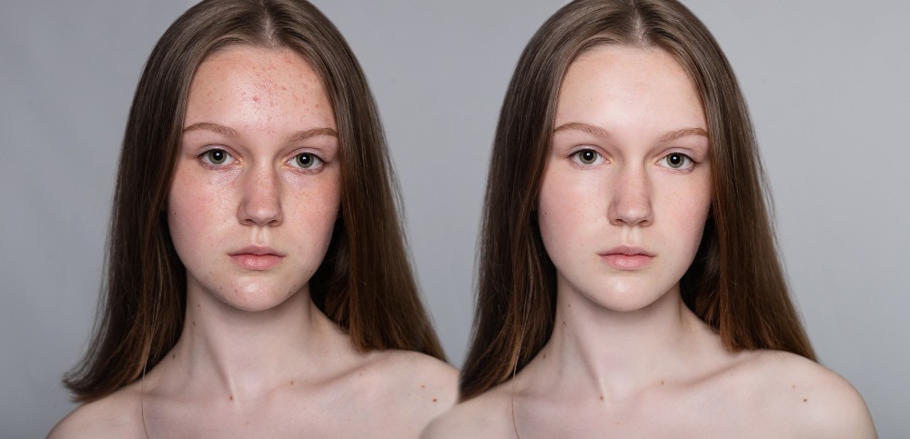 Bitkisel Özlerle Doğal Cilt Bakımı: Veela Pigment Correcting Cream