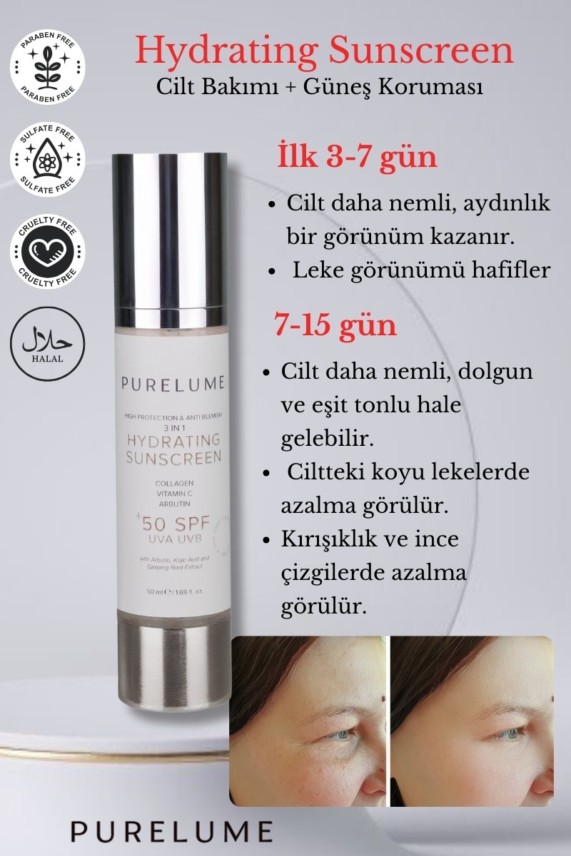 Kolajen Ve Arbutin Içerikli, Aydınlatıcı, Yaşlanma Ve Leke Karşıtı Güneş Kremi 50 Spf