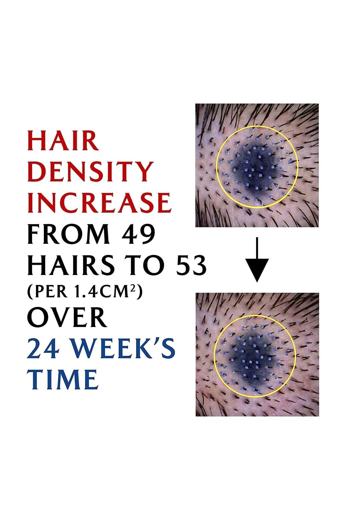 Dermatical Hair-loss Saç Dökülmesine Karşı Şampuan 200ml
