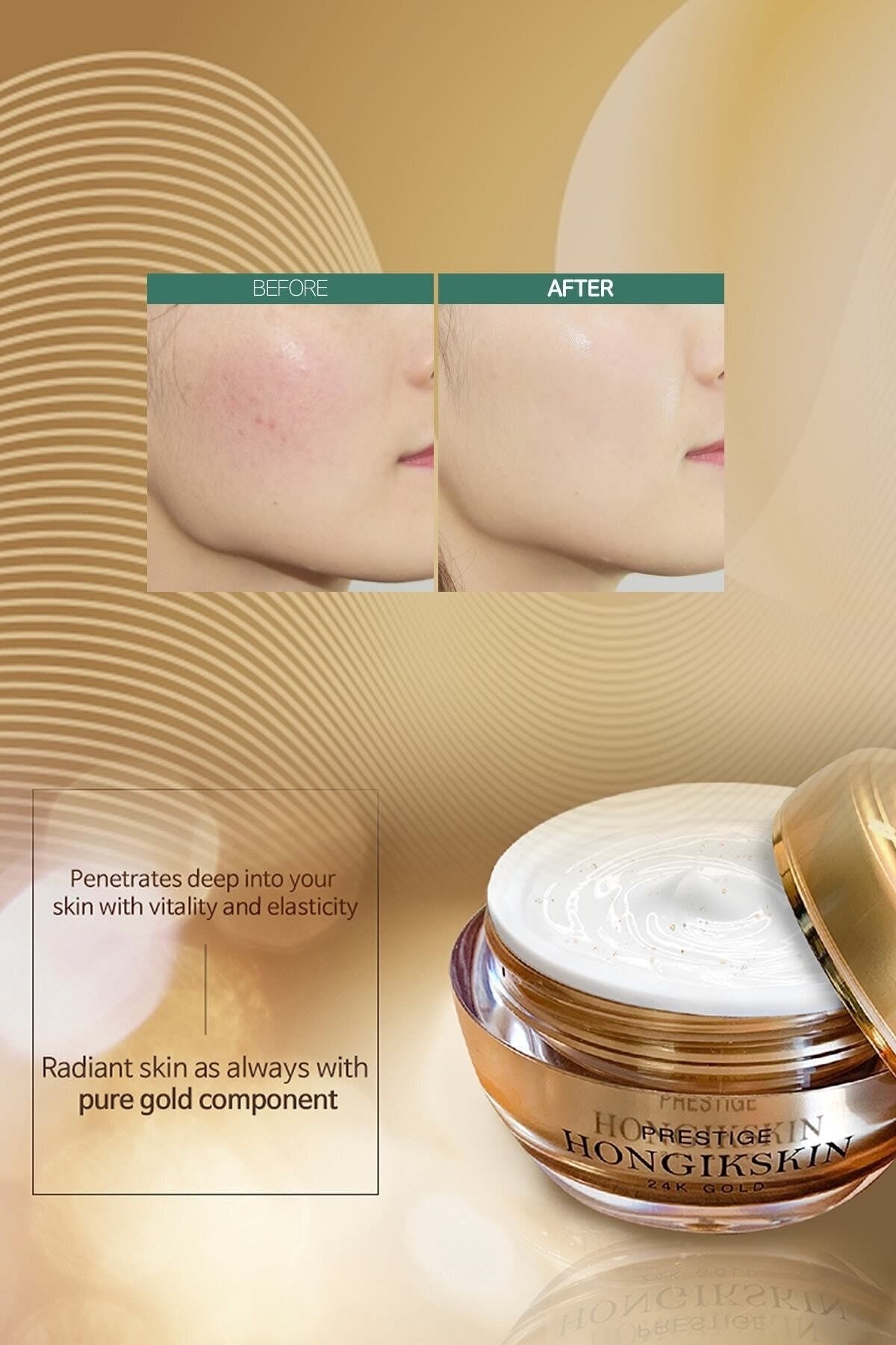 Hongikskin Prestige 24k Gold Memory Cream ( Anti Aging - Aydınlatıcı - Onarıcı )