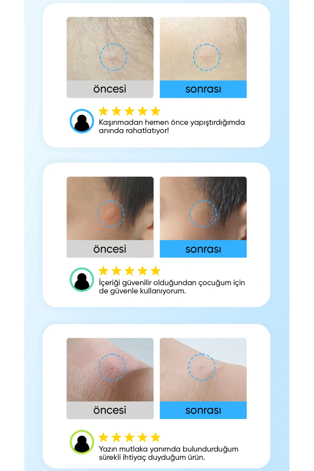 Yatıştırıcı ve Önleyici Mikro İğneli Bant Soothing Care Microcone Patch 12li