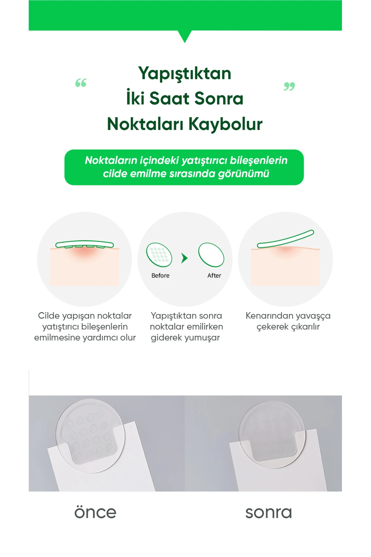 Mikro Noktalı Salisilik Asit Bandı ZZA Dot 45li