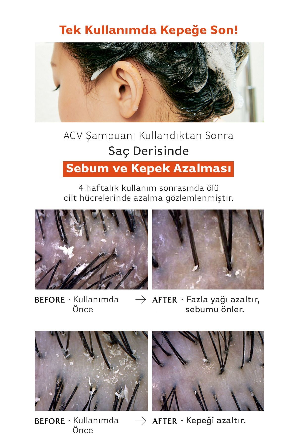 Saç Derisini Canlandıran ve Parlaklaştıran Sirke Özlü Şampuan LADOR ACV Vinegar Shampoo 430ML