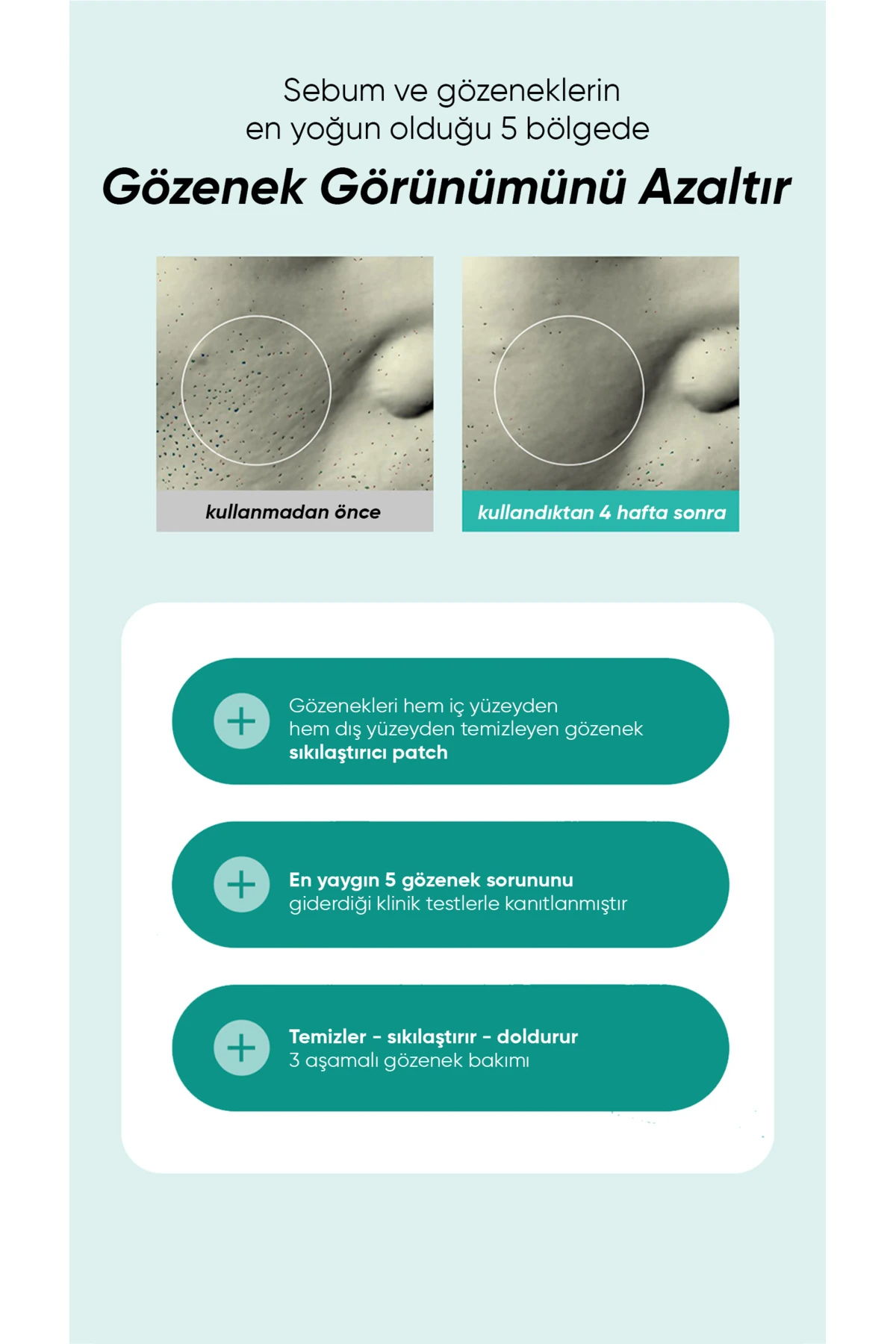 Gözenek Bakım Bandı PORE CARE MICROCONE PATCH (4 patch)