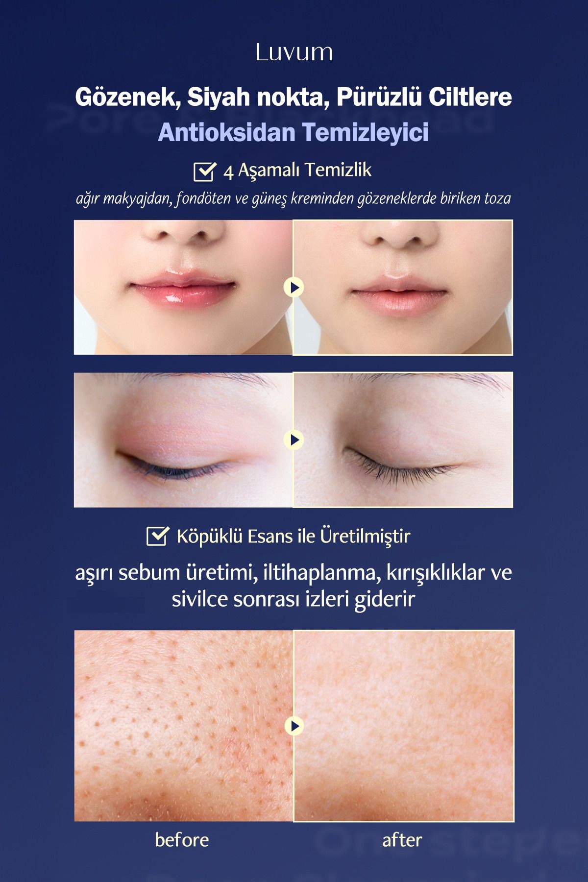 Siyah Nokta ve Gözenek Temizleme Pedi LUVUM Pore Deep Cleansing Pad 1 adet