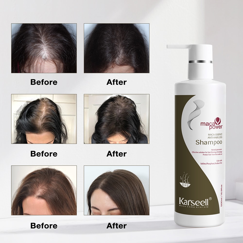 Maca Essence  Hair Loss Dökülme Şampuanı 500 ML