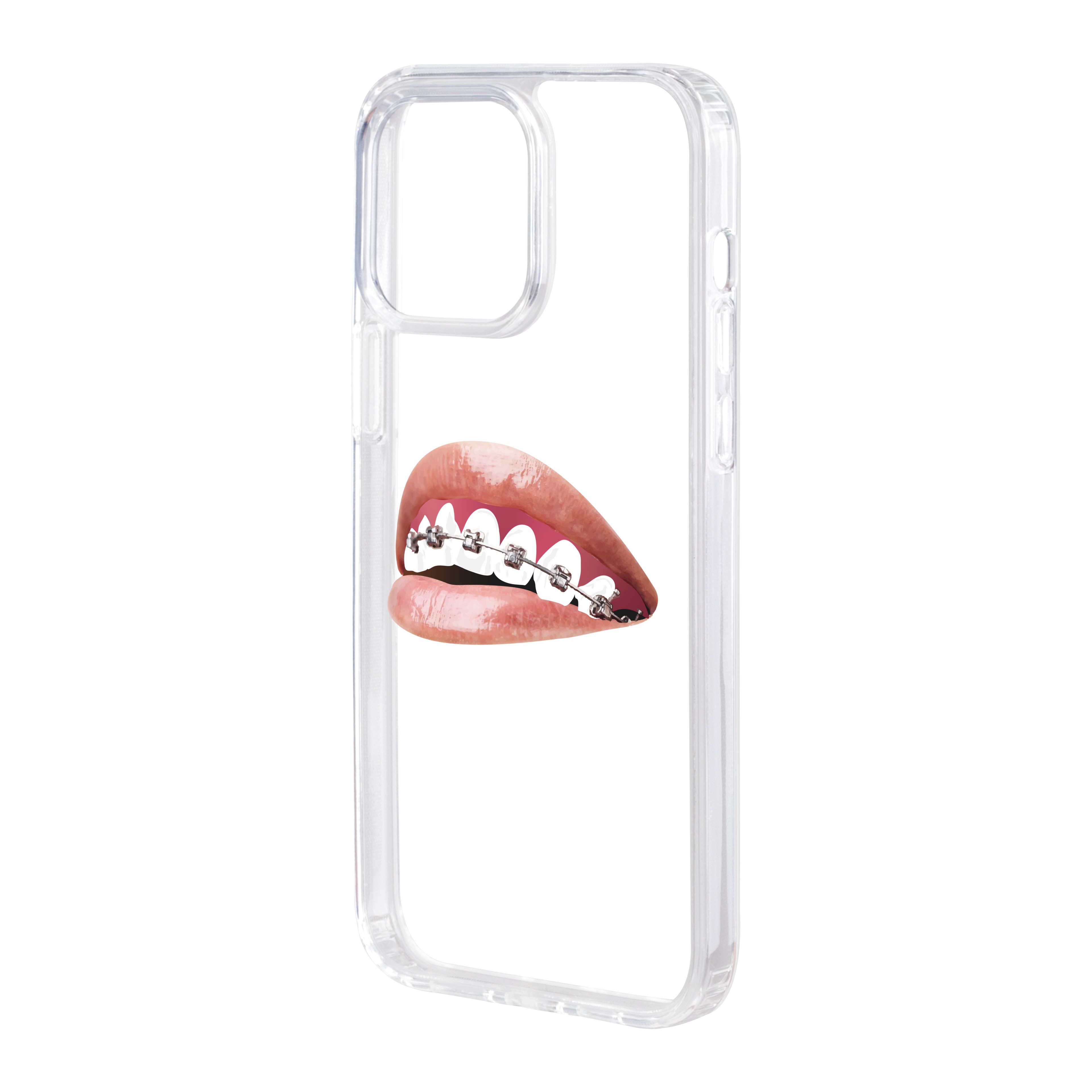 Orthodontist - iPhone Clear Case