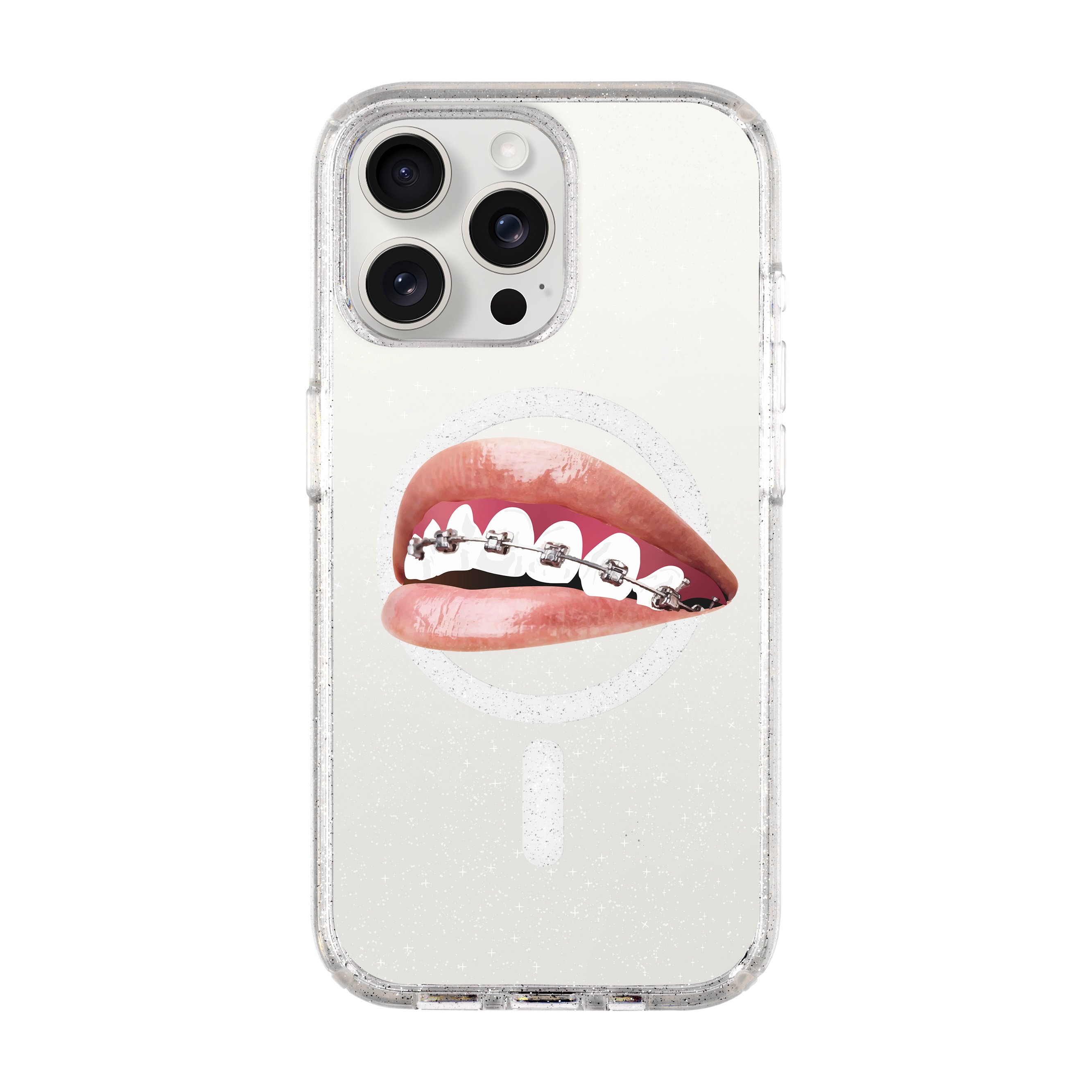 ORTHODONTIST-iPhone Shiny Case with MagSafe