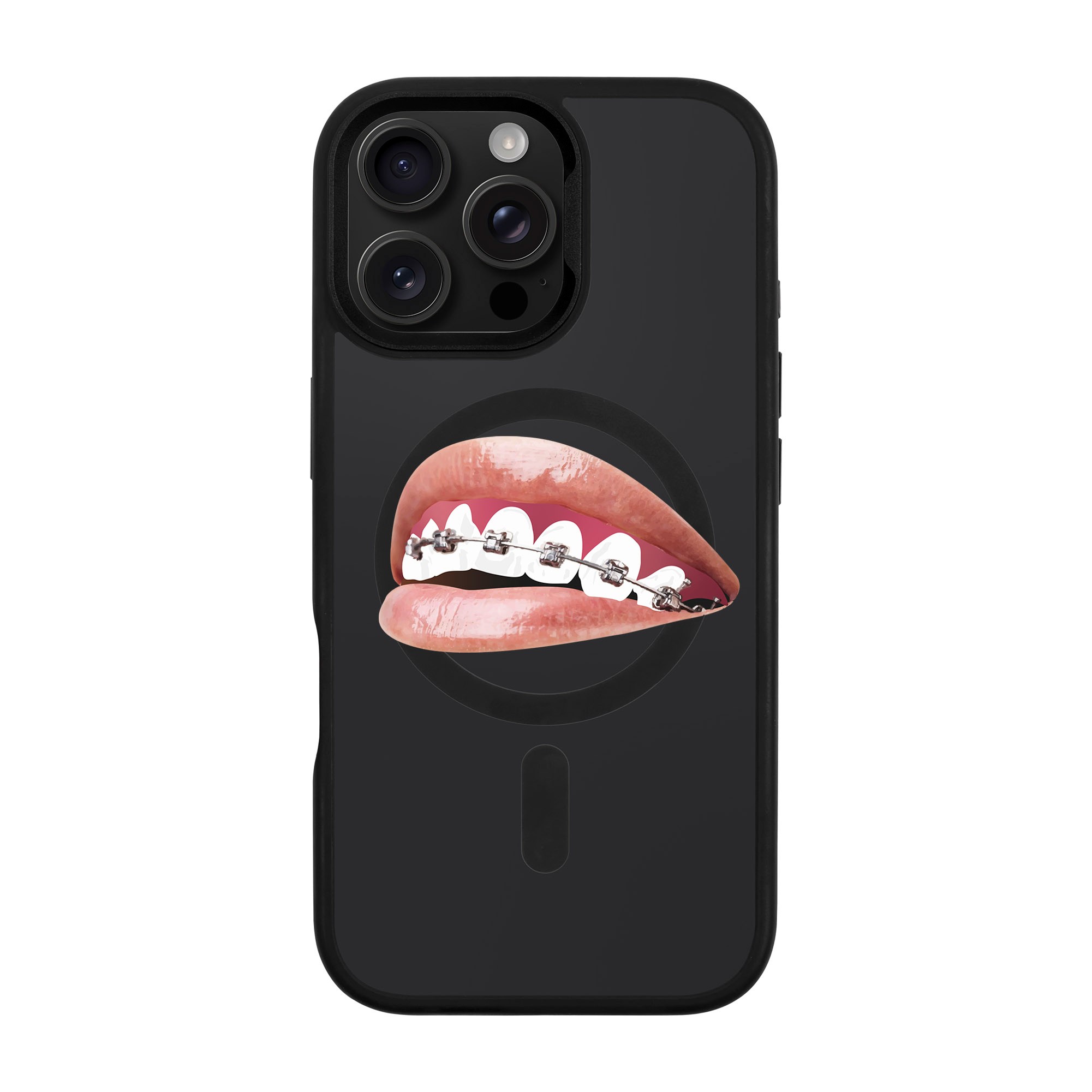 ORTHODONTIST-iPhone Rise Kılıf MagSafe Özellikli