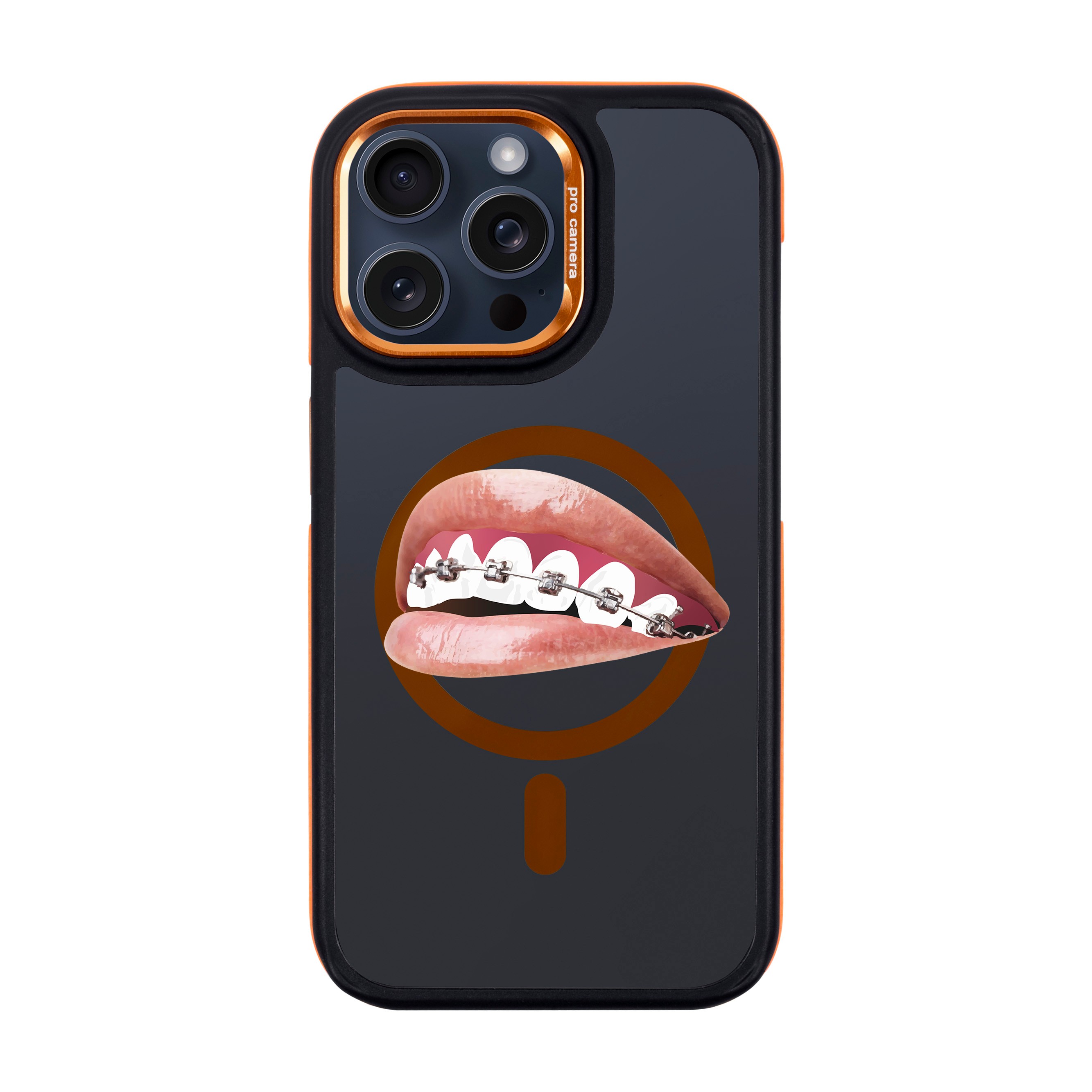 ORTHODONTIST-iPhone Dark Case with MagSafe