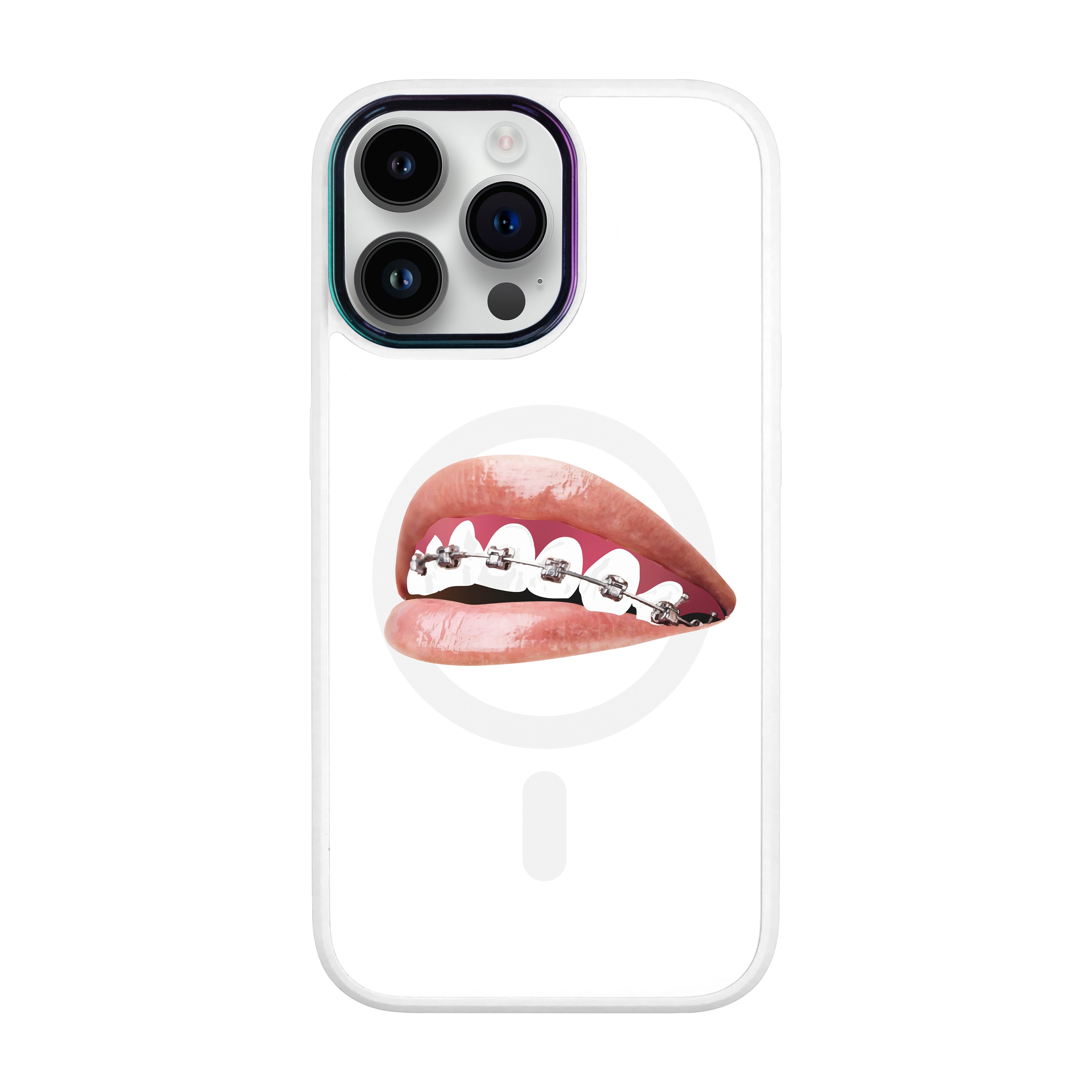 ORTHODONTİST - iPhone Vigor Case with Magsafe