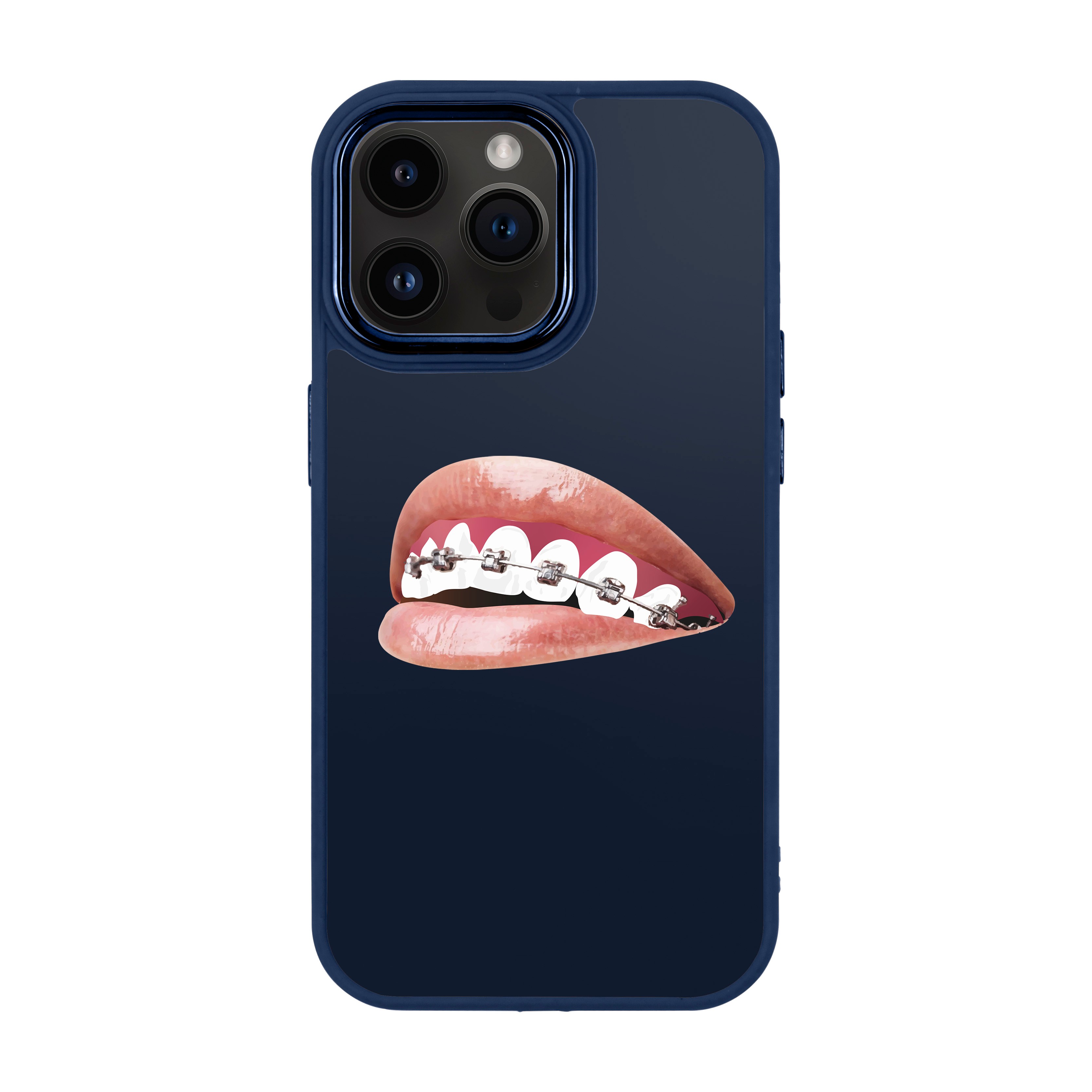 ORTHODONTIST - iPhone Proof Case