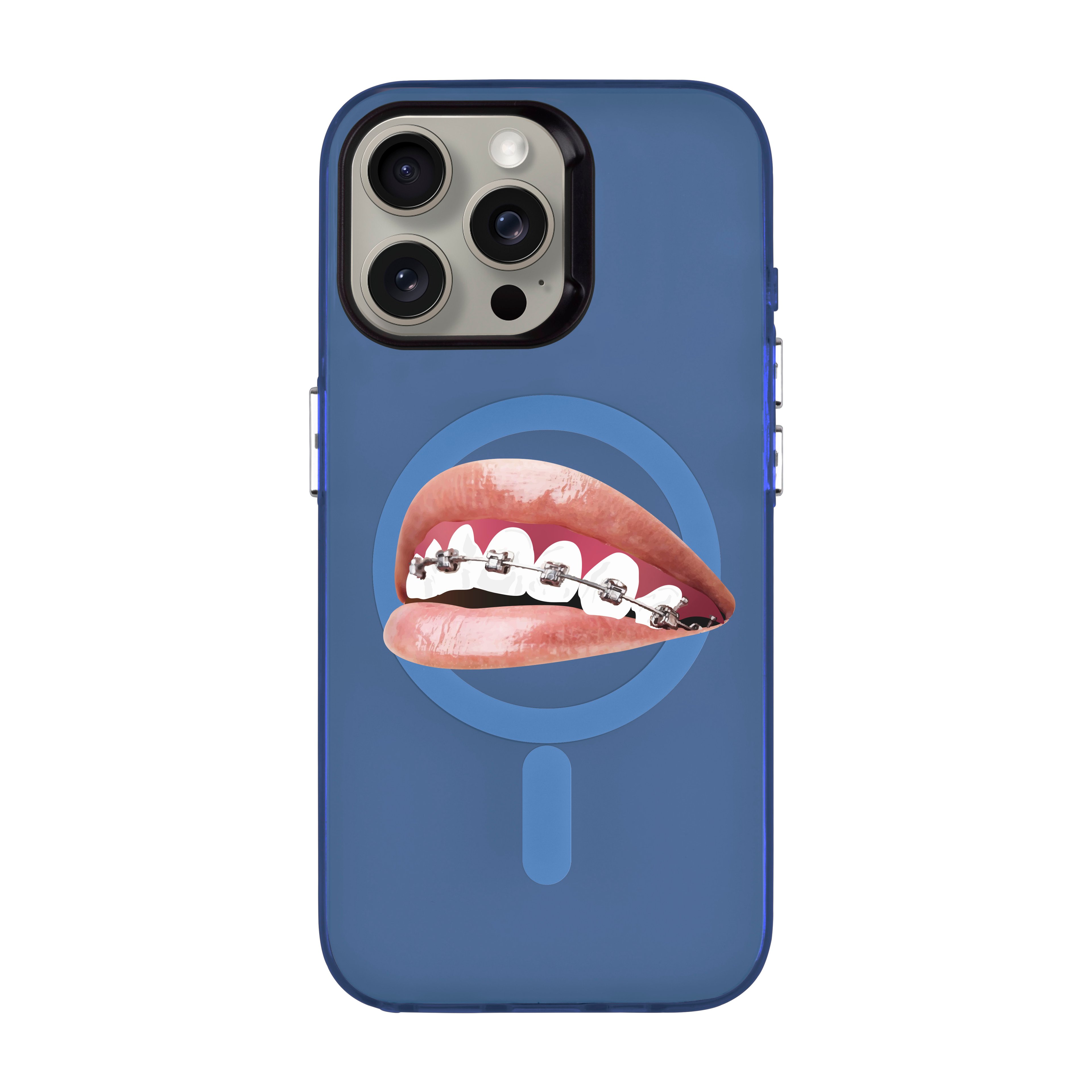 ORTHODONTIST-iPhone Hold Kılıf MagSafe Özellikli