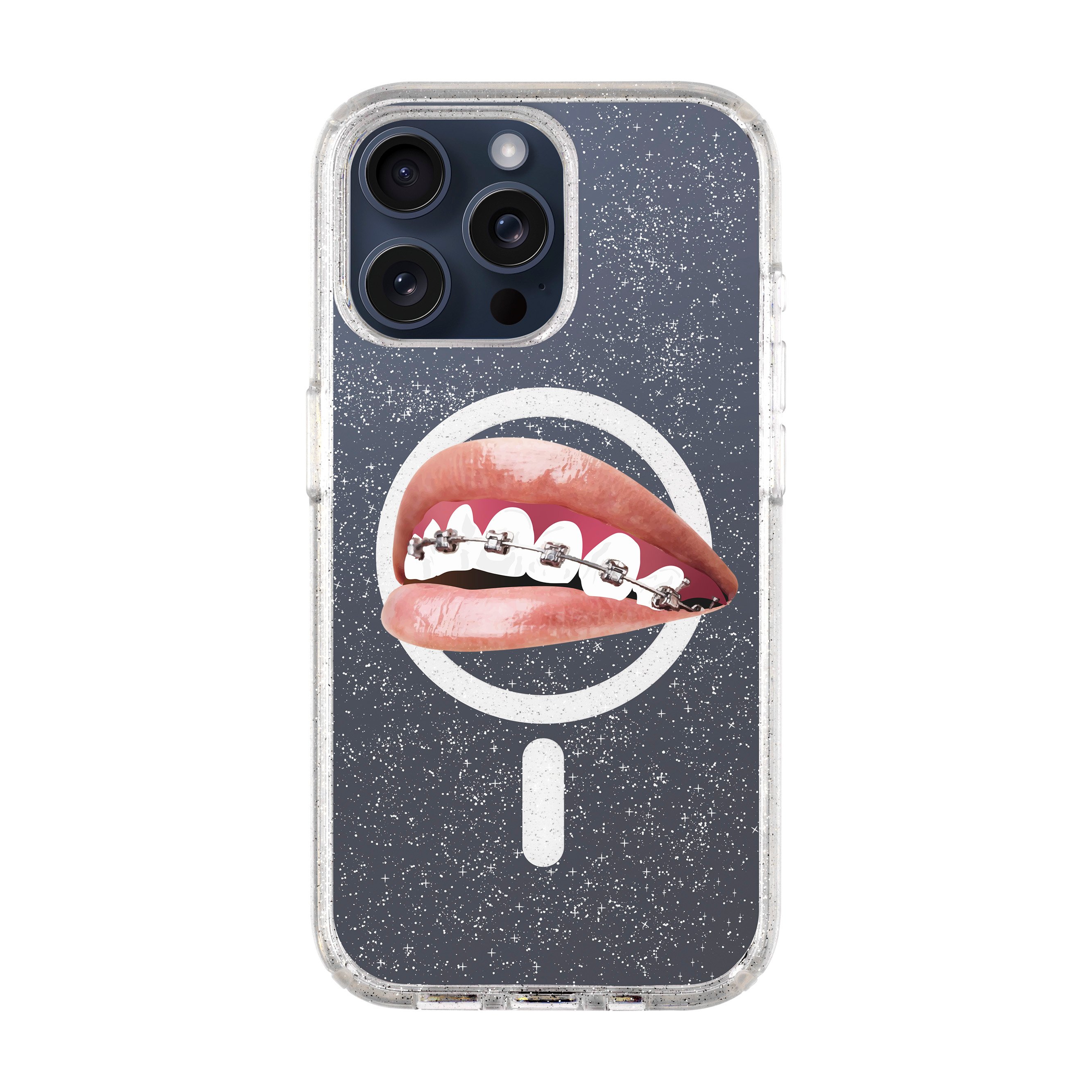 ORTHODONTIST-iPhone Shiny Case with MagSafe