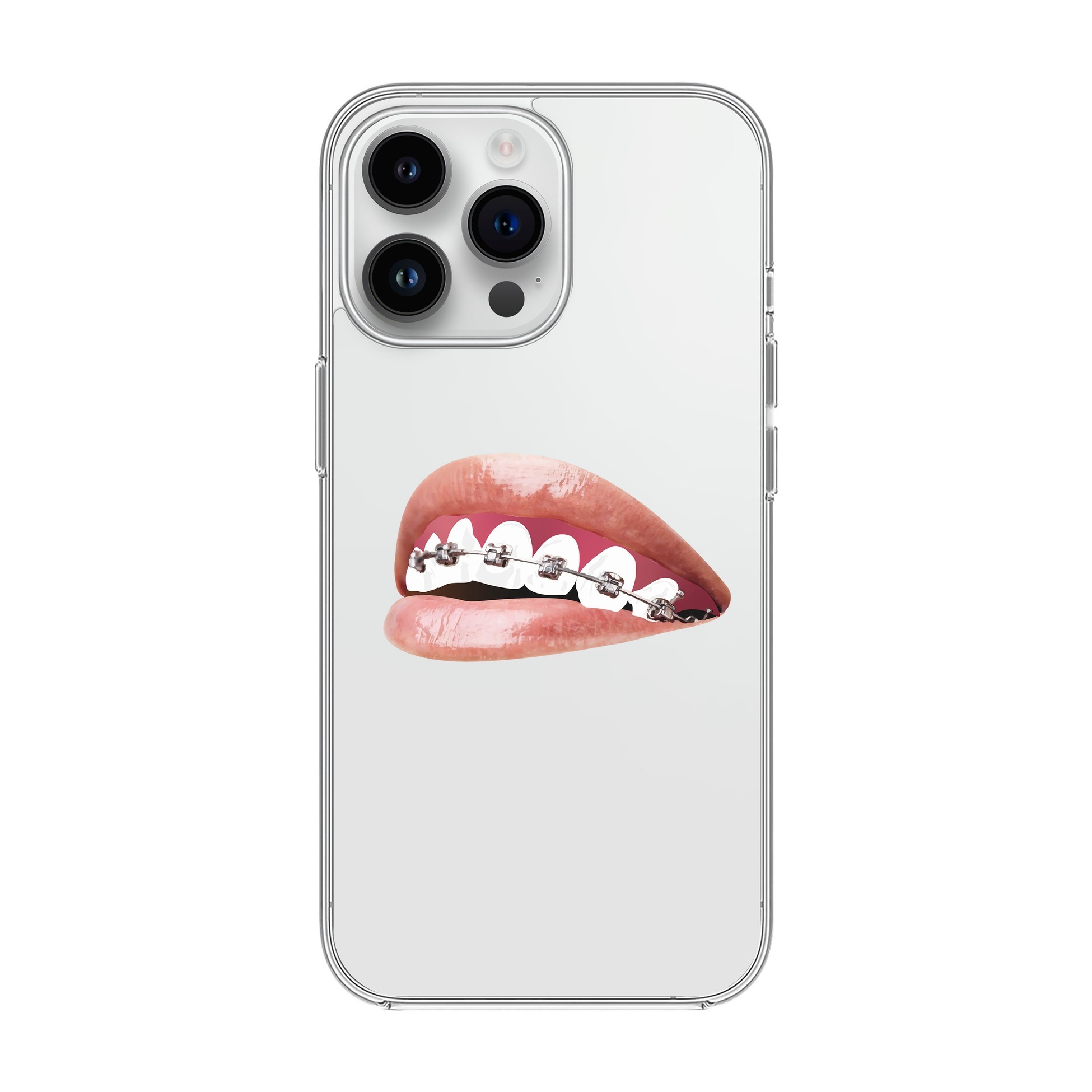 Orthodontist - iPhone Clear Case