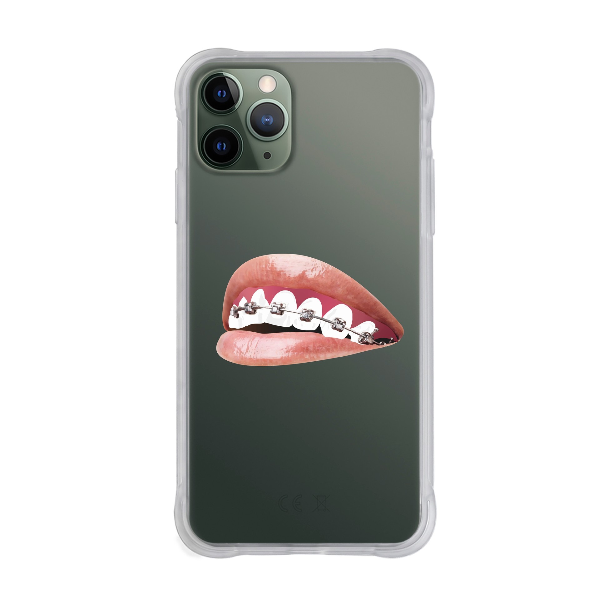 Orthodontist - iPhone Drop Case