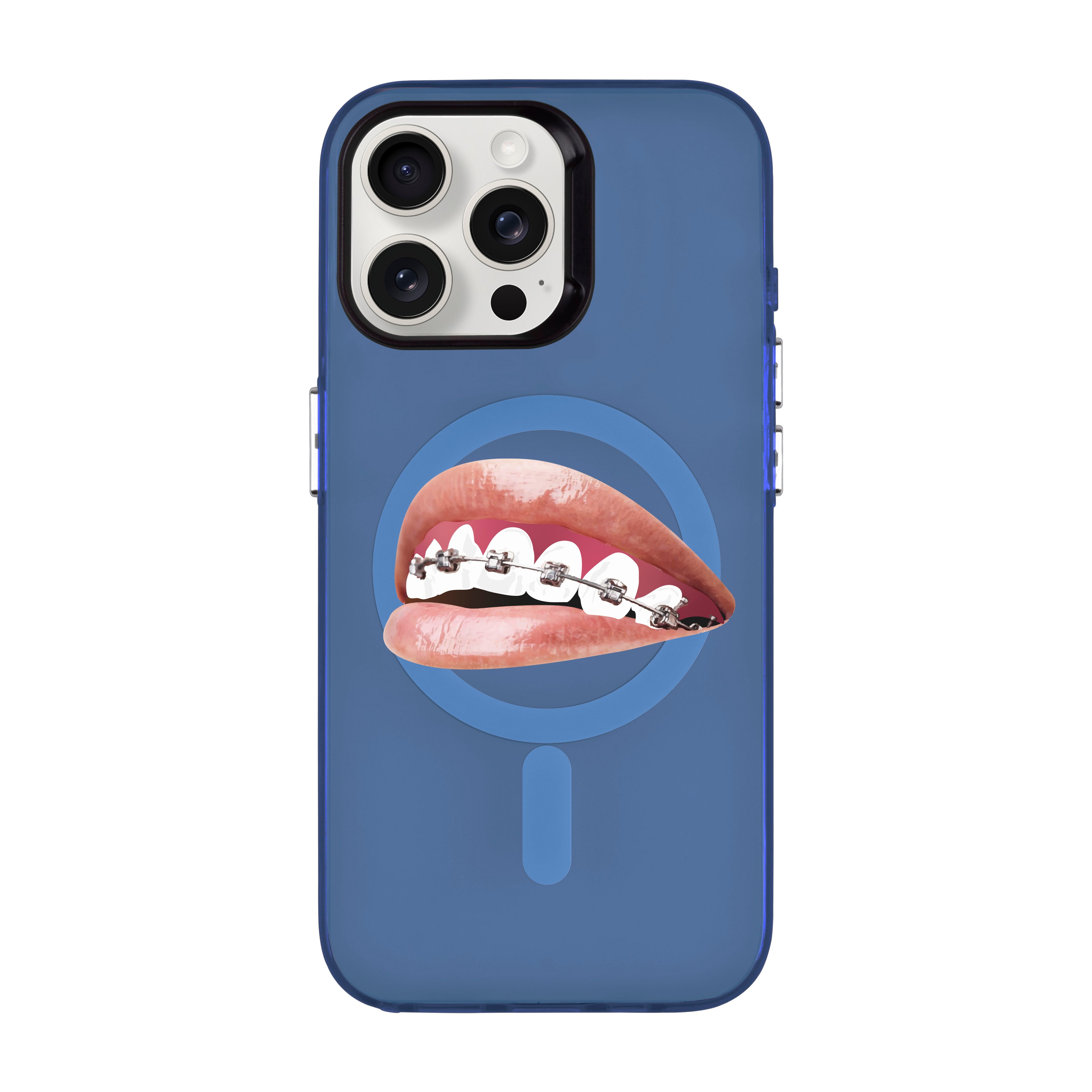 ORTHODONTIST-iPhone Hold Kılıf MagSafe Özellikli