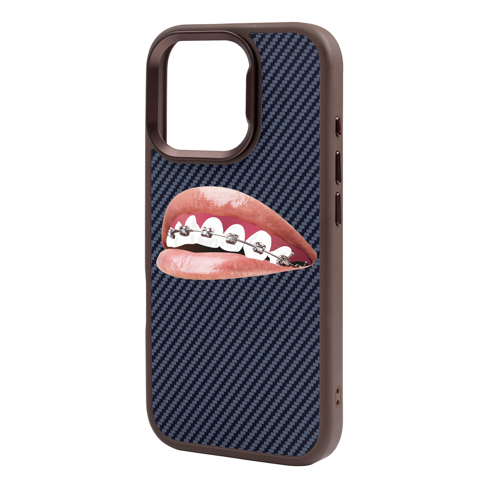 ORTHODONTIST-iPhone Plaid Kılıf MagSafe Özellikli