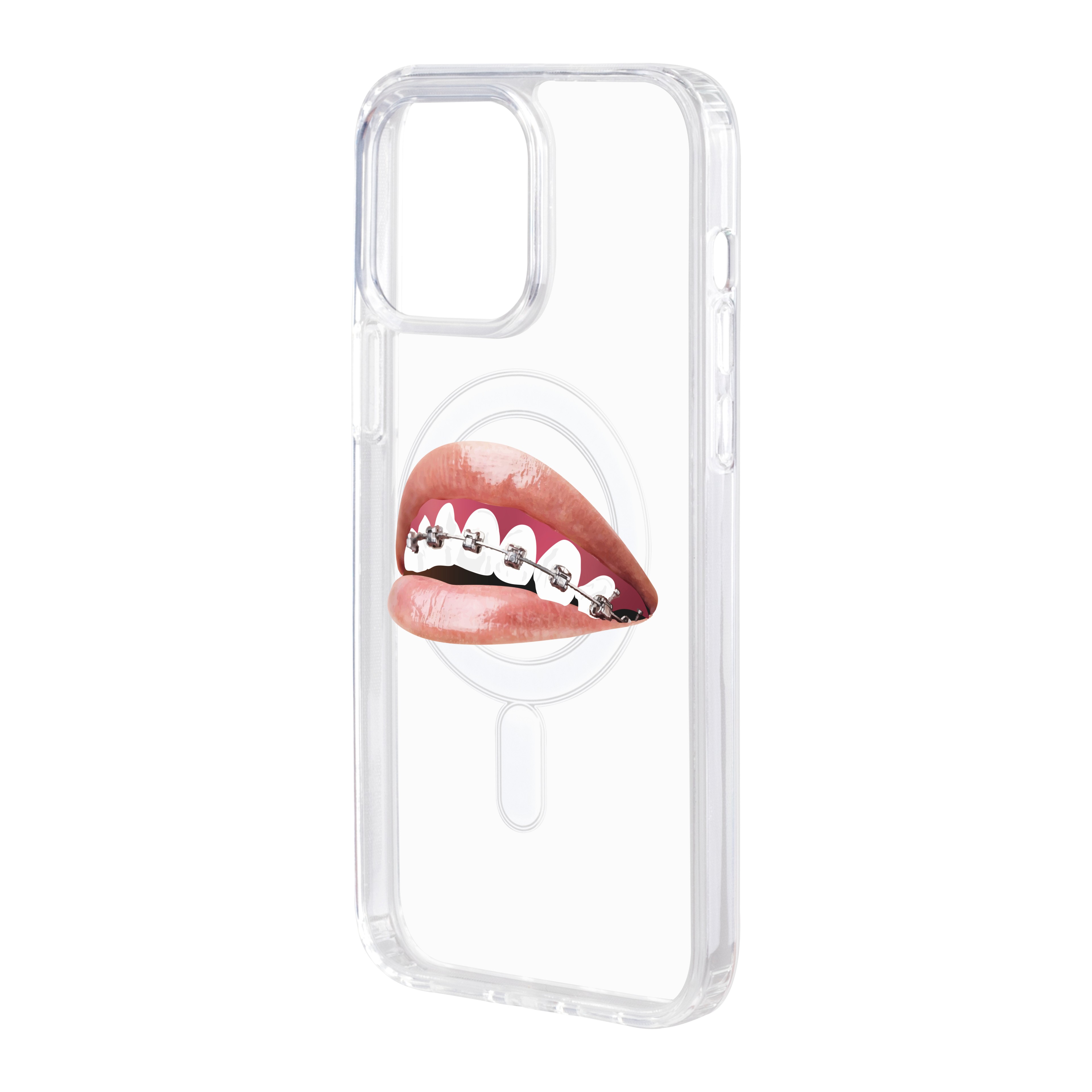 Orthodontist - iPhone Clear Case with MagSafe