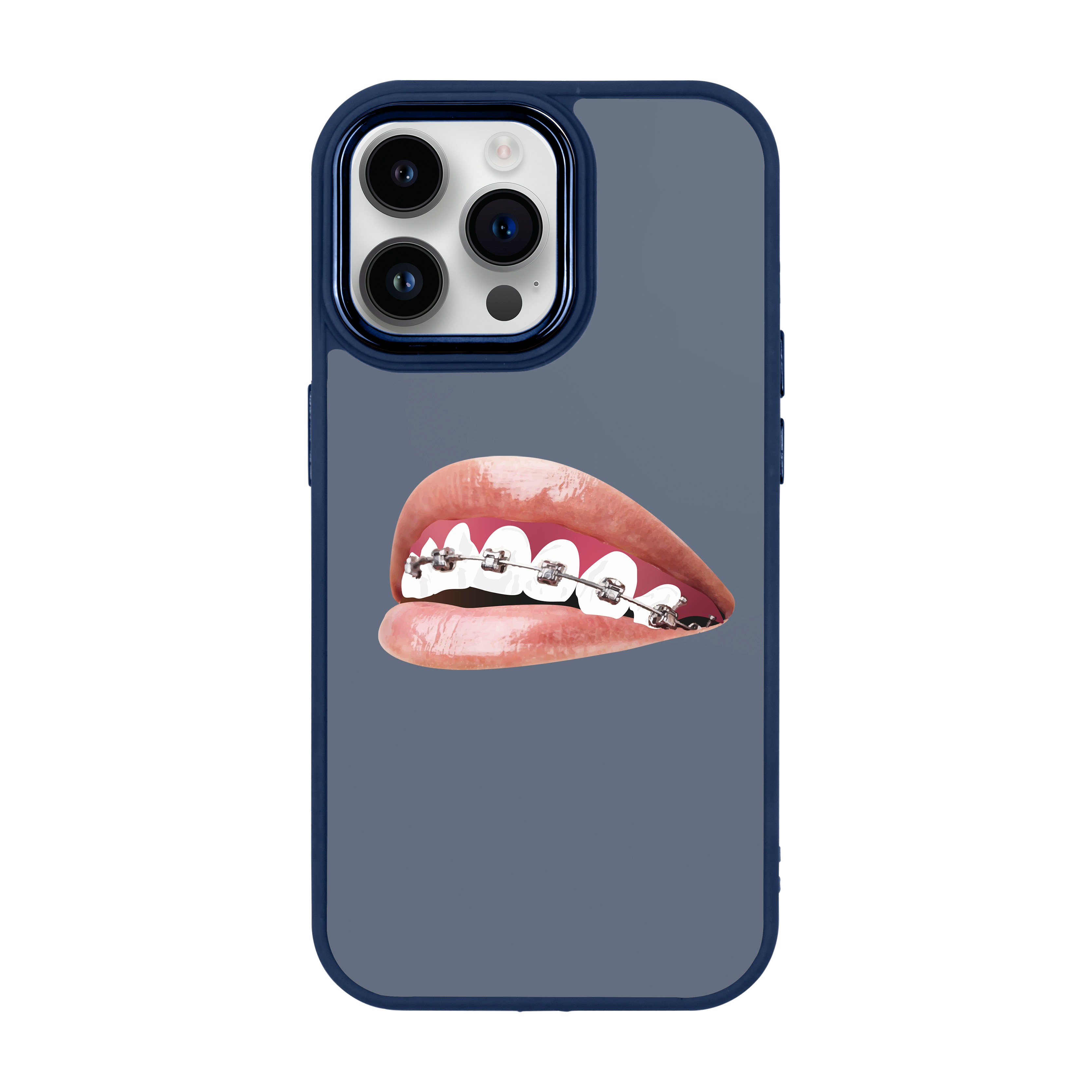 ORTHODONTIST - iPhone Proof Case