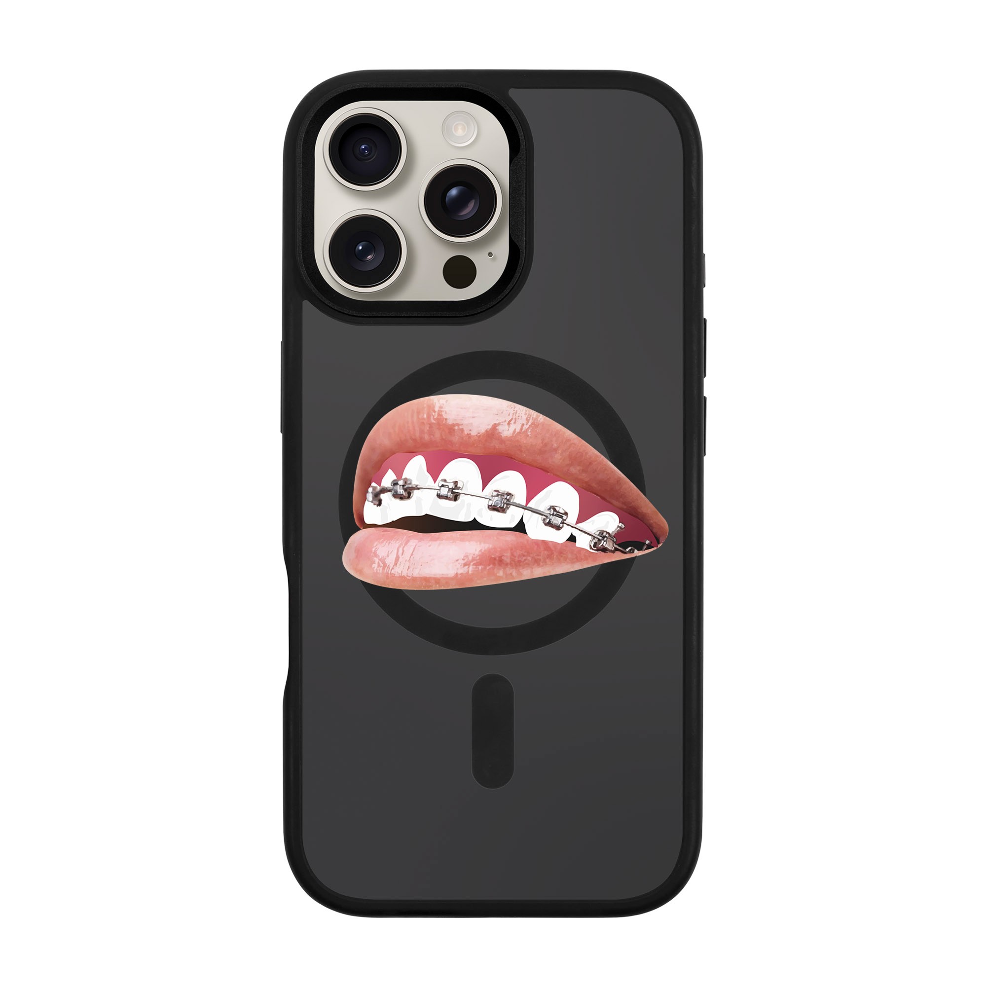 ORTHODONTIST-iPhone Rise Kılıf MagSafe Özellikli