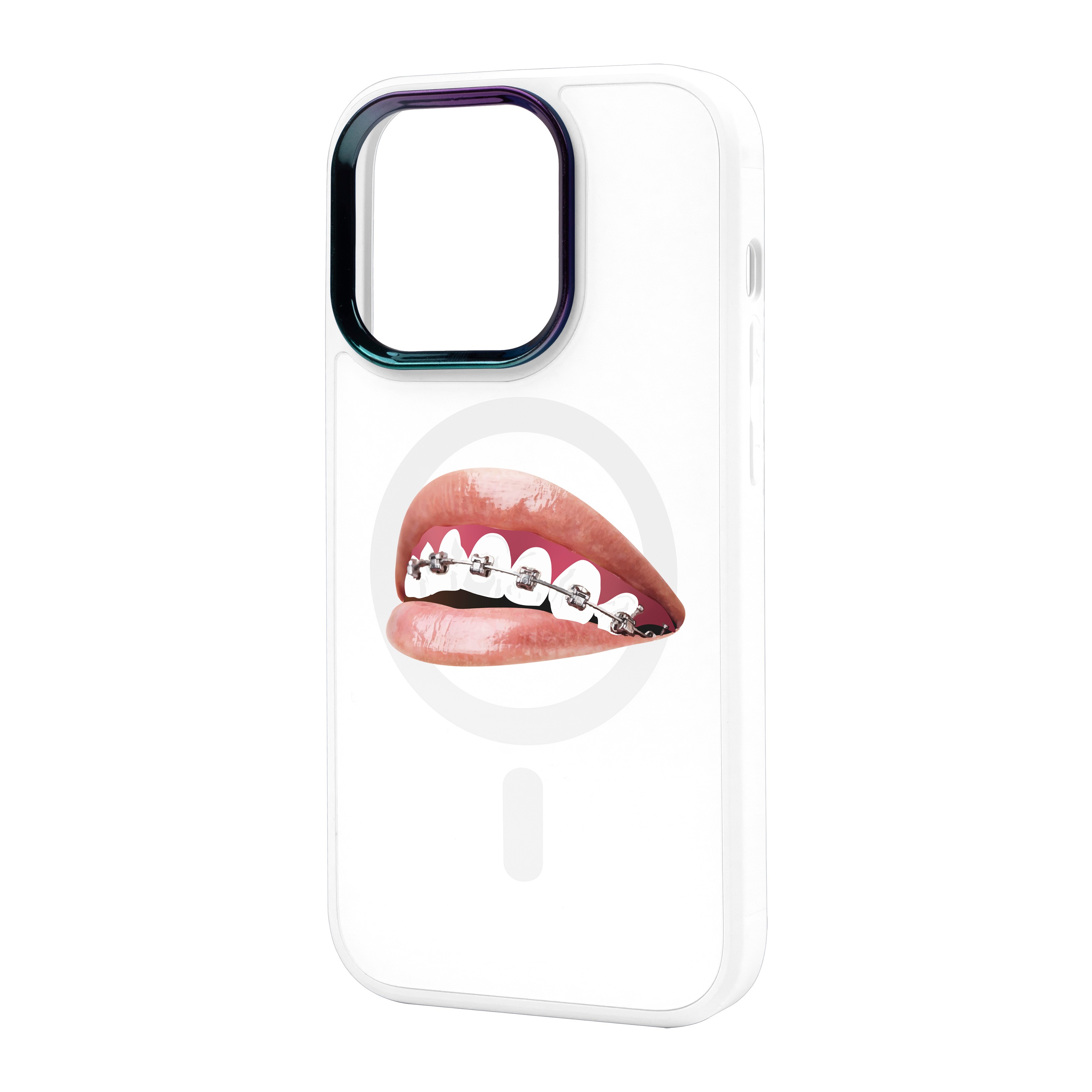 ORTHODONTİST - iPhone Vigor Case with Magsafe