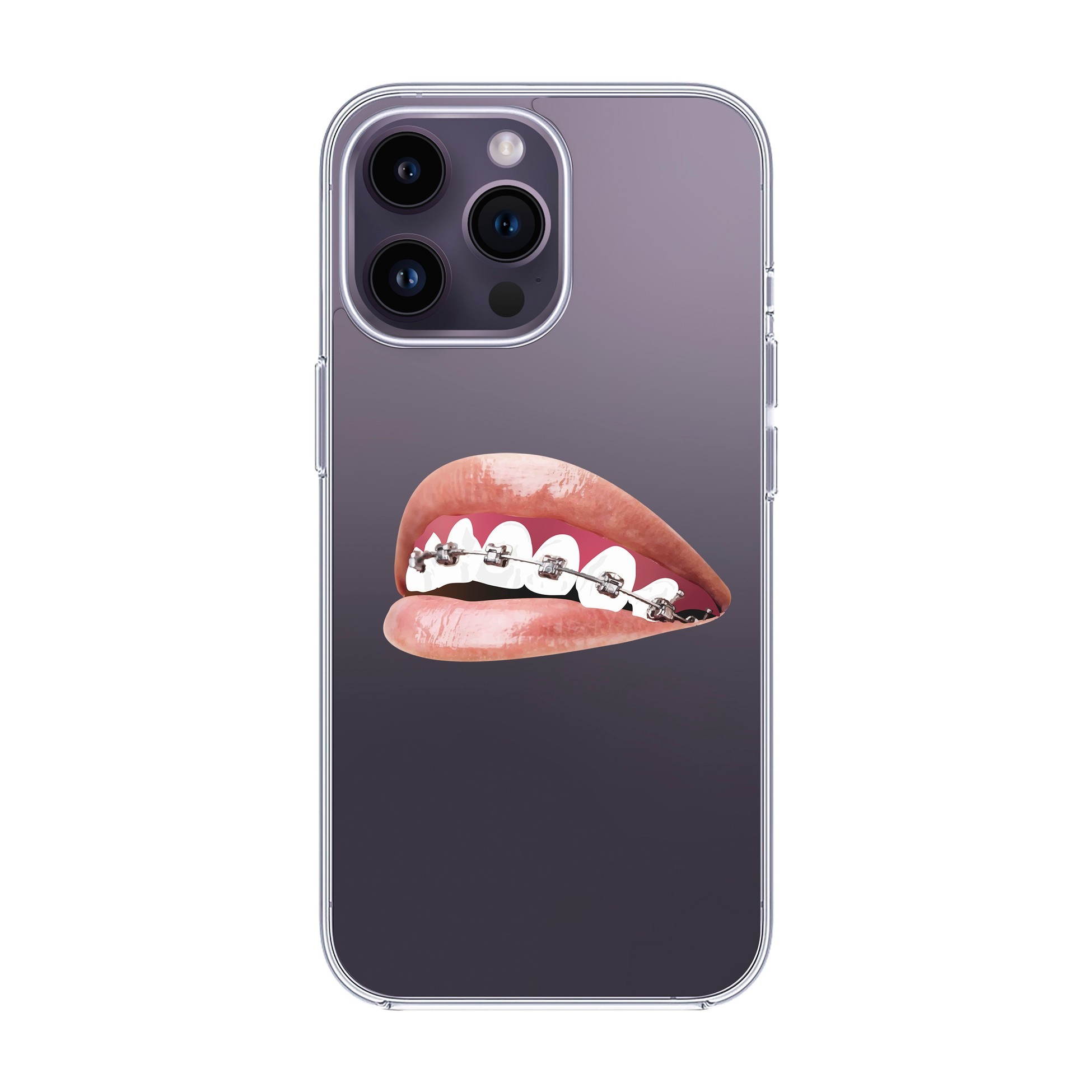 ORTHODONTIST-iPhone Solid Kılıf