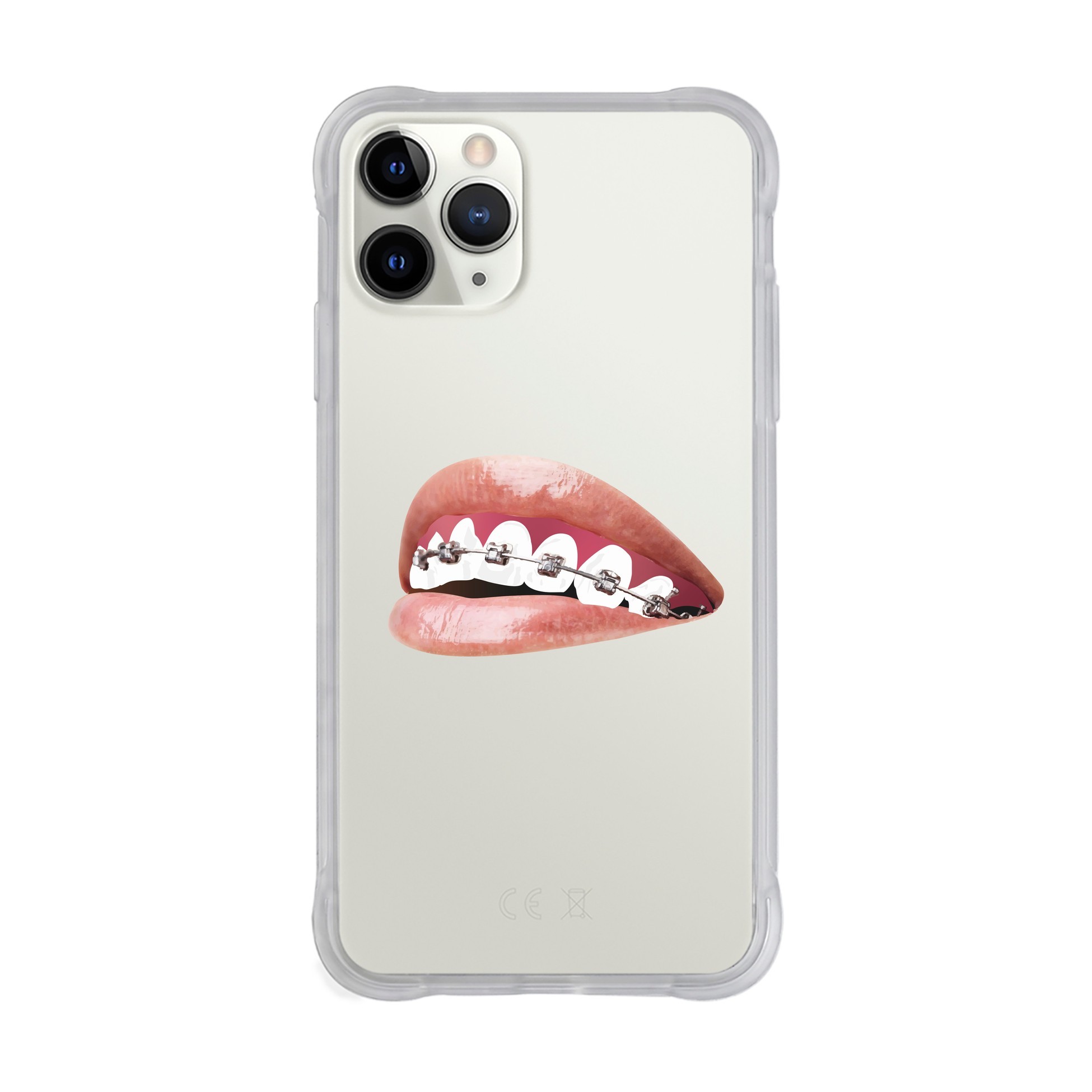 Orthodontist - iPhone Drop Case